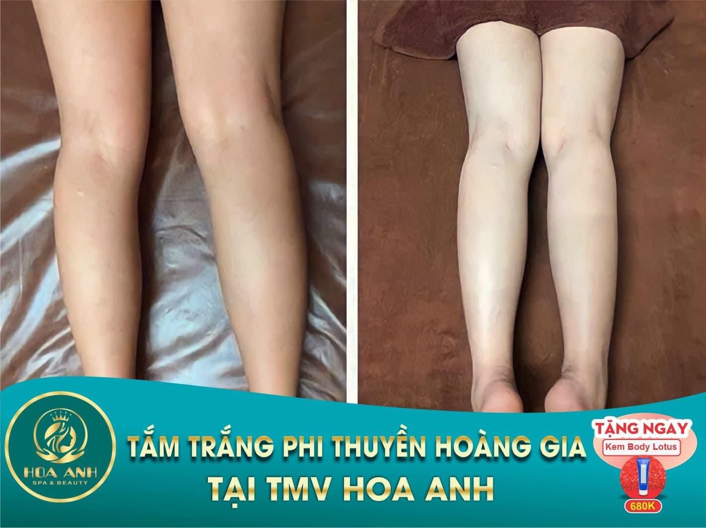 tắm trắng phi thuyền