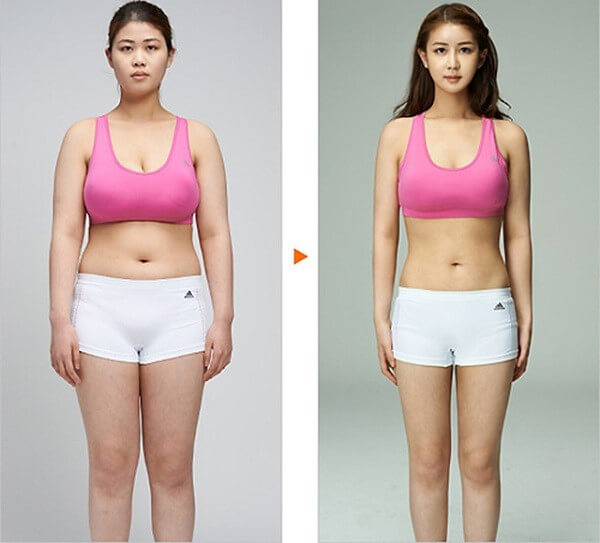 giảm béo cấp tốc