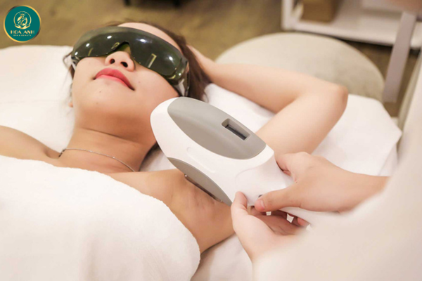 triệt lông vĩnh viễn