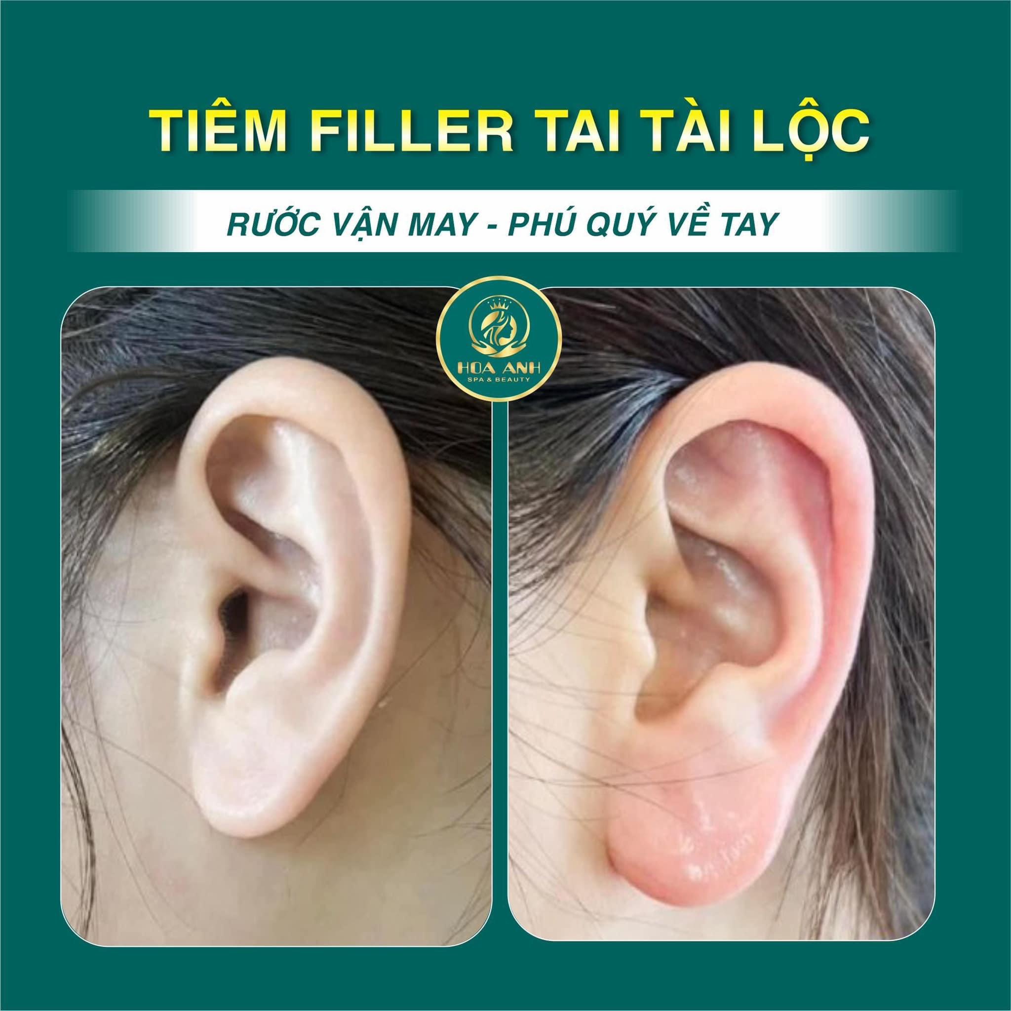 tiêm tai tài lộc