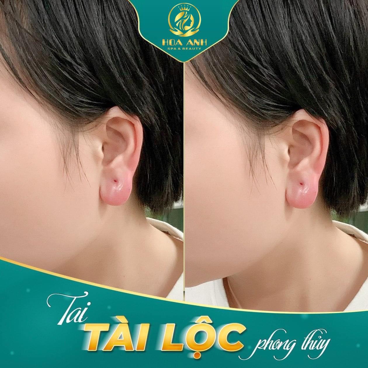 tiêm tai tài lộc
