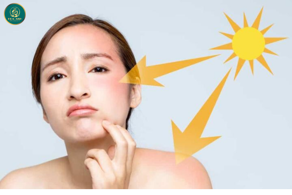 thoa kem chống nắng bảo vệ da