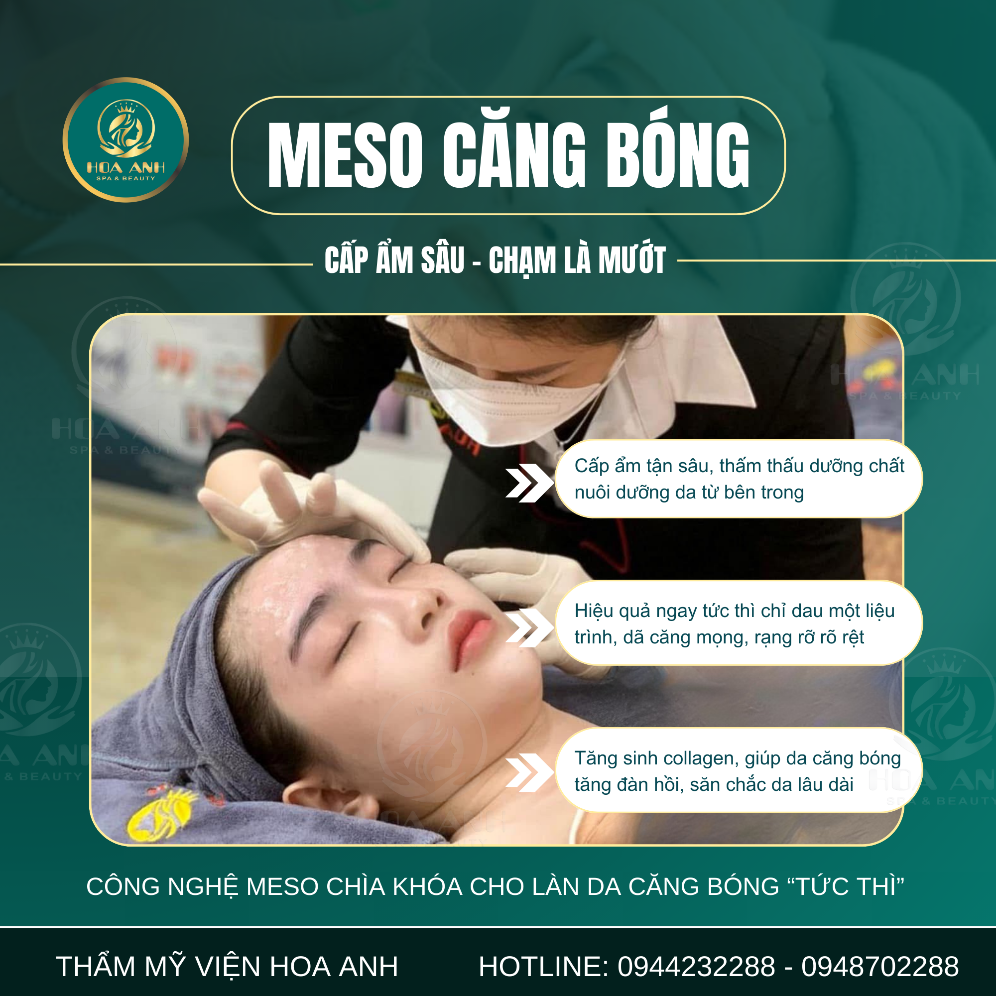 tiêm meso căng bóng