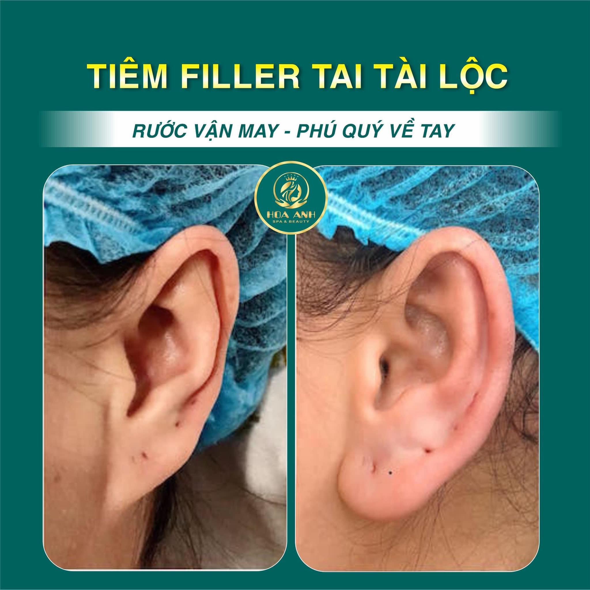 tiêm tai phong thủy