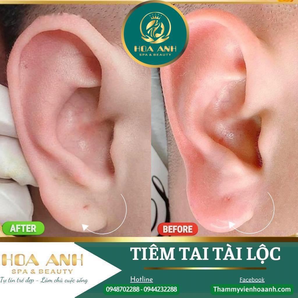 tiêm tai phong thủy