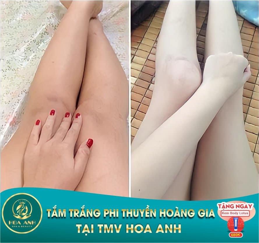 tắm trắng