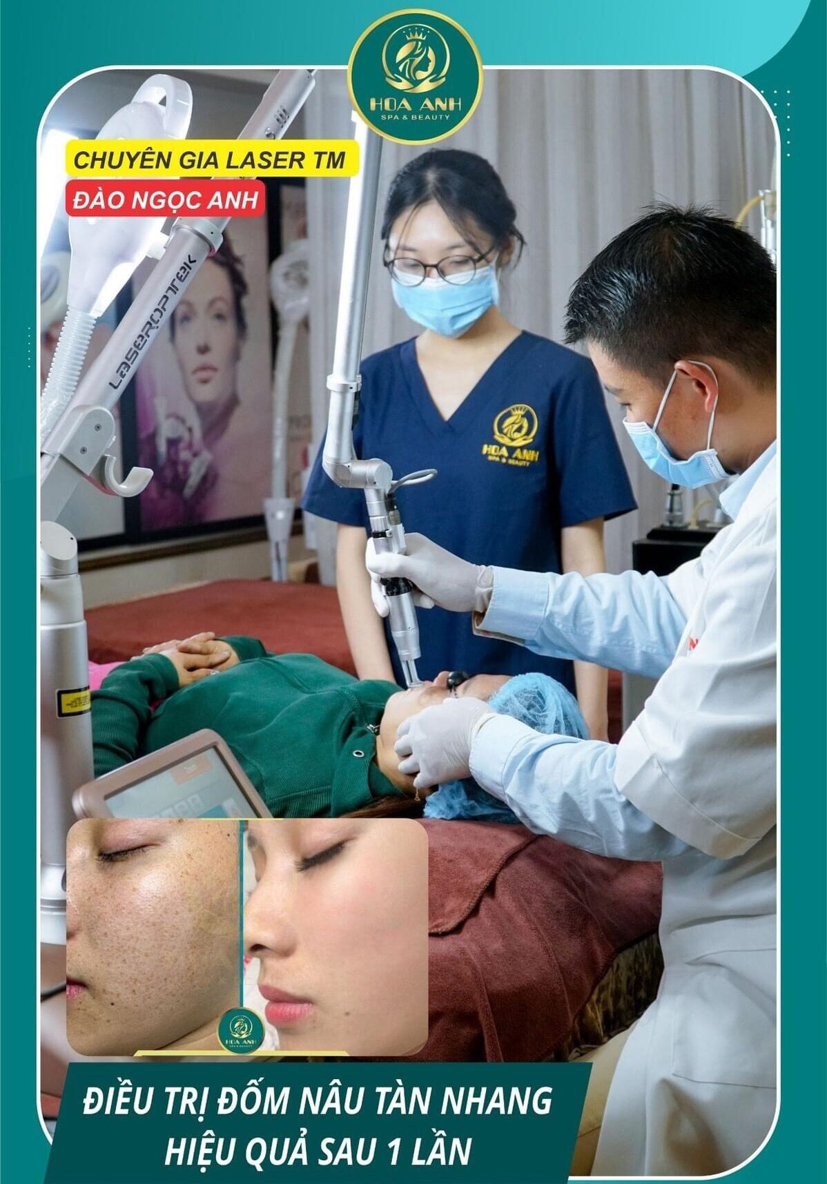 xóa tàn nhang tại Hoa Anh