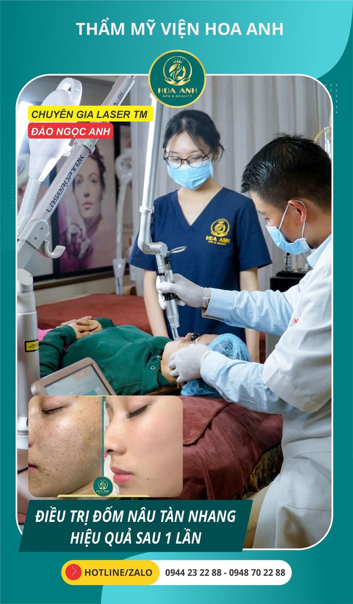 xóa tàn nhang tại Hoa Anh