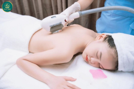 triệt lông vĩnh viễn