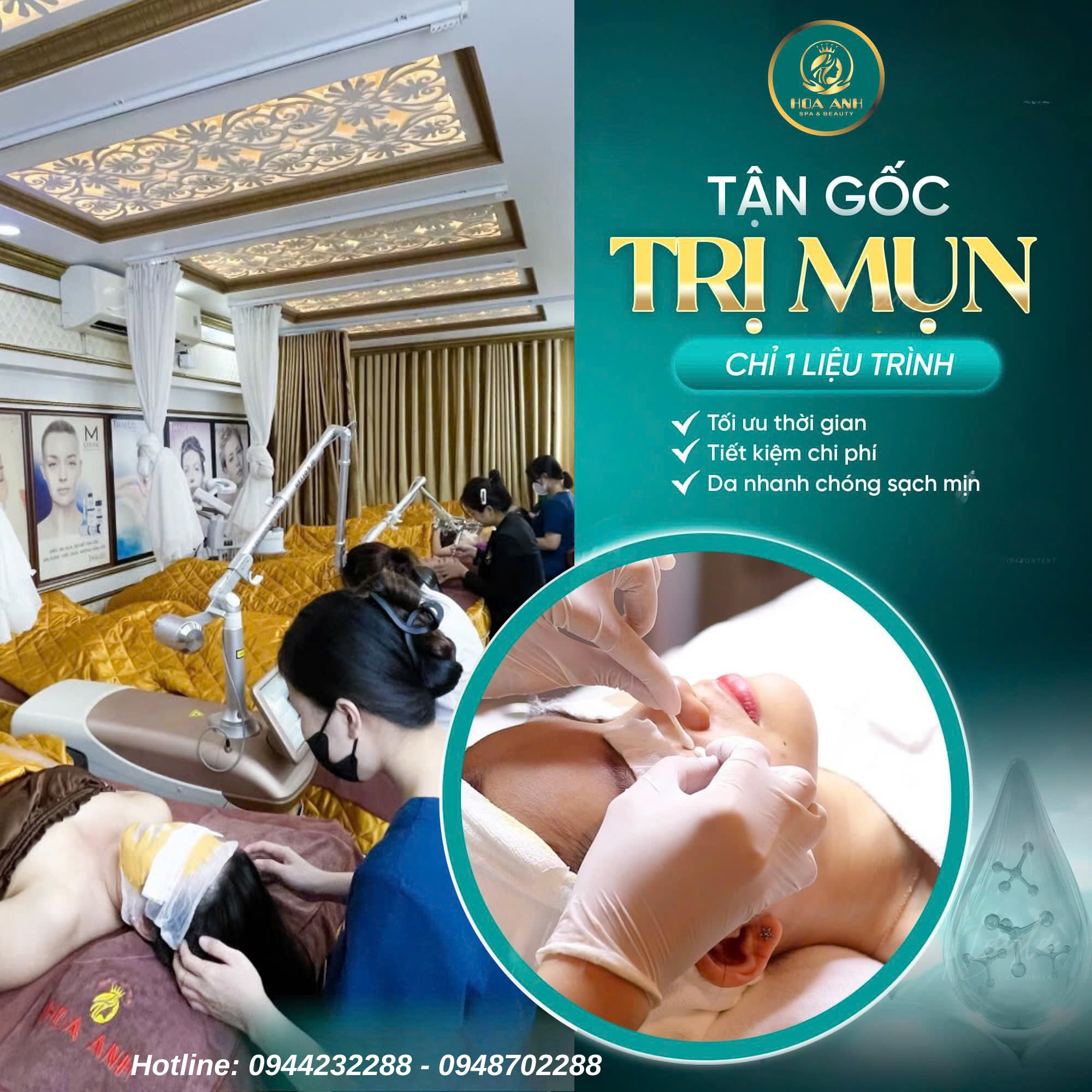 trị mụn tại Hoa Anh