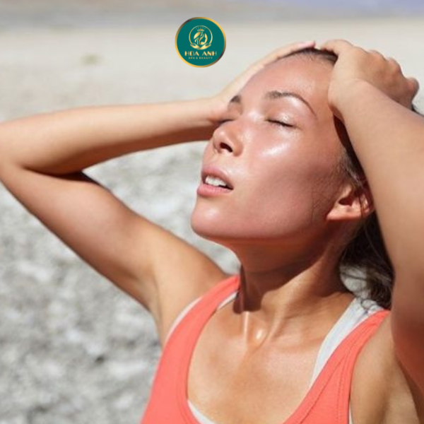 da bị nám do tiếp xúc nắng