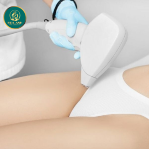 Triệt lông bikini