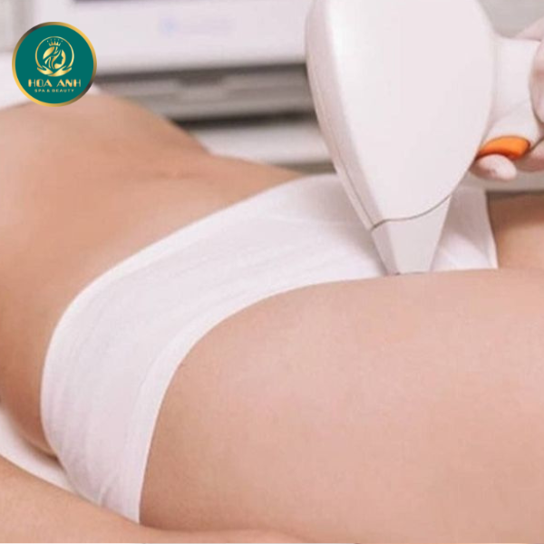 Triệt lông bikini