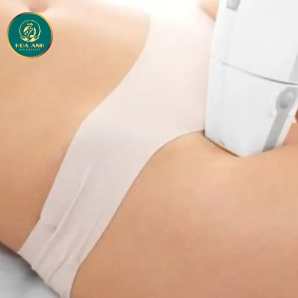 Triệt lông bikini