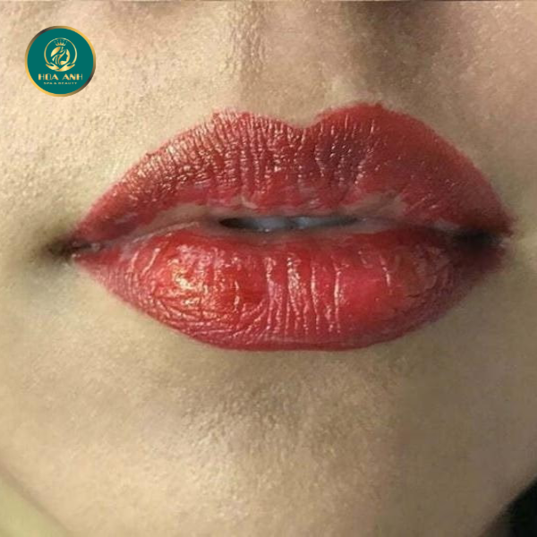 môi phun xăm bị hỏng, lỗi