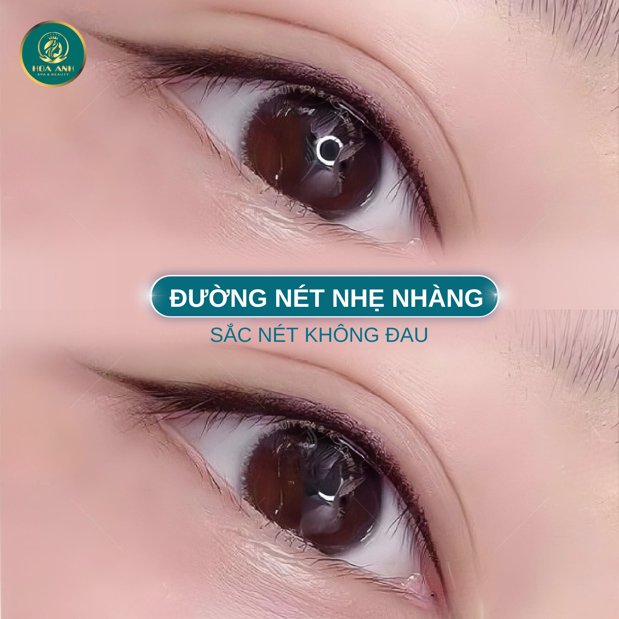Phun mí mắt