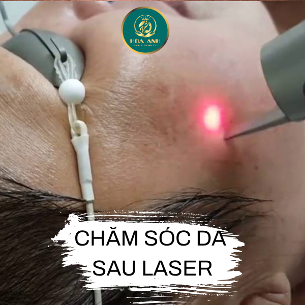 chăm sóc da sau Laser