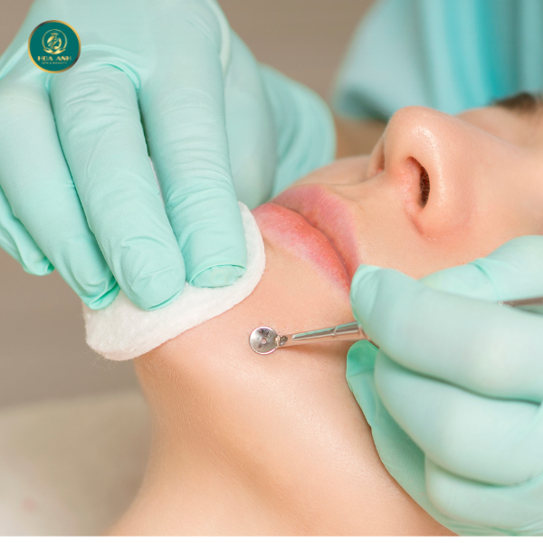Điều trị mụn